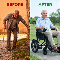 Foldable Electric Wheelchair, 20+ Miles Long Range Motorized Electric Wheelchair, Senior-Friendly Power Chair with 360° Joystick, All Terrain Smart Mobility Scooter, Black — Before & After